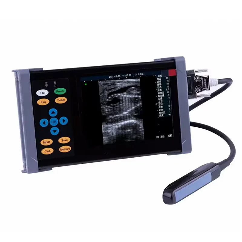 Veterinary Ultrasound Pregnancy Ultrasound Scanner for Animal Dog Vet Portable Digital Ultrasound
Veterinary Ultrasound Pregnancy Ultrasound Scanner for Animal Dog Vet Portable Digital Ultrasound