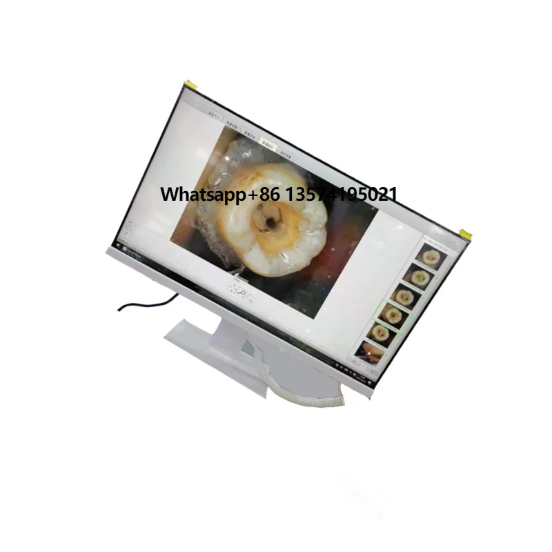 Portable Endoscope with Handle and Screen for Precise, Easy Intraoral Examinations
Portable Endoscope with Handle and Screen for Precise, Easy Intraoral Examinations