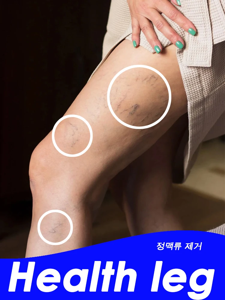 Therapy Leg Repair Pen Relieves Leg Bulge Discomfort Improving Blood Circulation Varicose Veins Pen Skin Care Product New
Therapy Leg Repair Pen Relieves Leg Bulge Discomfort Improving Blood Circulation Varicose Veins Pen Skin Care Product New