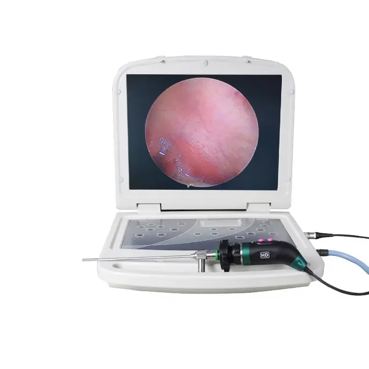 All-in-one Video video Medical Endoscopy endoscopy machine ent endoscopy video medical endoscope
All-in-one Video video Medical Endoscopy endoscopy machine ent endoscopy video medical endoscope