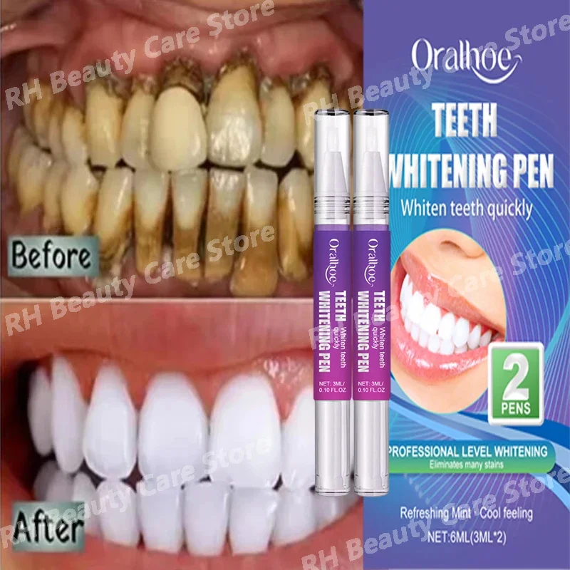 Quick Teeth Whtening Toothpaste Pen Remove Plaque Stains Cleaning Oral Hygiene Bleaching Dental Tools Fresh Breath Tooth Care
Quick Teeth Whtening Toothpaste Pen Remove Plaque Stains Cleaning Oral Hygiene Bleaching Dental Tools Fresh Breath Tooth Care