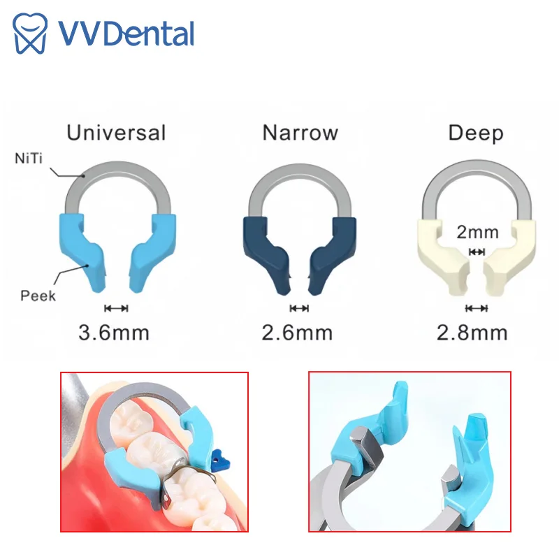 Dental Matrix Bands NITI Metal Matrices Clamp Ring Sectional Contoured Matrix System Clamping Dentist Tools Dentistry Material
Dental Matrix Bands NITI Metal Matrices Clamp Ring Sectional Contoured Matrix System Clamping Dentist Tools Dentistry Material