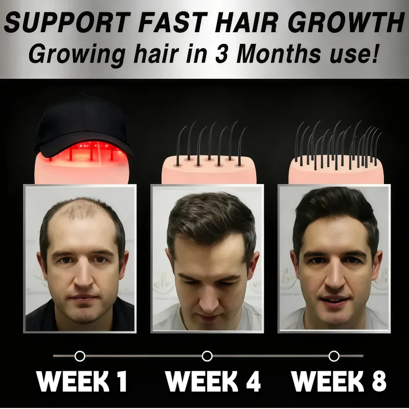Перезаряжаемая беспроводная лазерная шапочка для роста волос 650 нм LLLT для удобного лечения роста волос дома
Перезаряжаемая беспроводная лазерная шапочка для роста волос 650 нм LLLT для удобного лечения роста волос дома