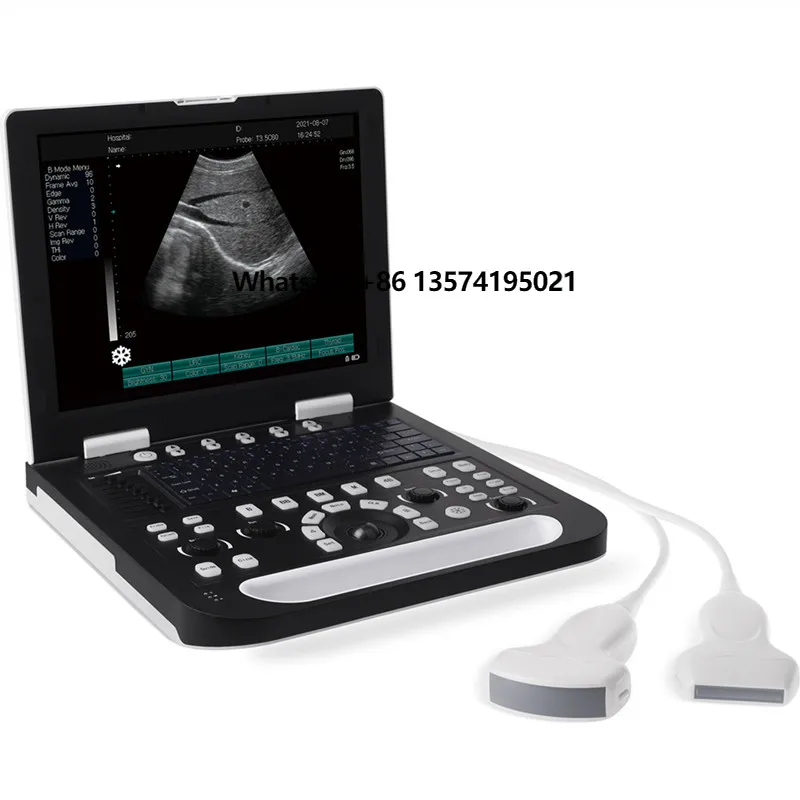 High Quality Hospital Use Portable All Digital Laptop Ultrasound Machine With Dual Probe Interface
High Quality Hospital Use Portable All Digital Laptop Ultrasound Machine With Dual Probe Interface