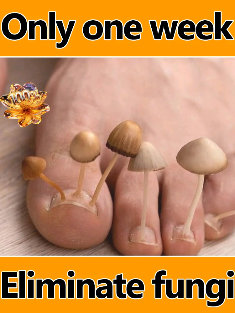 Выступающие фокусы на грибах. Это бы быть отличными.
Выступающие фокусы на грибах. Это бы быть отличными.