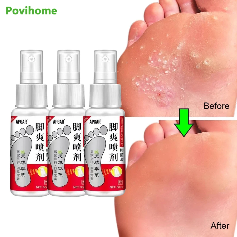 1/3 шт., антибактериальный крем для удаления запаха ног
1/3 шт., антибактериальный крем для удаления запаха ног