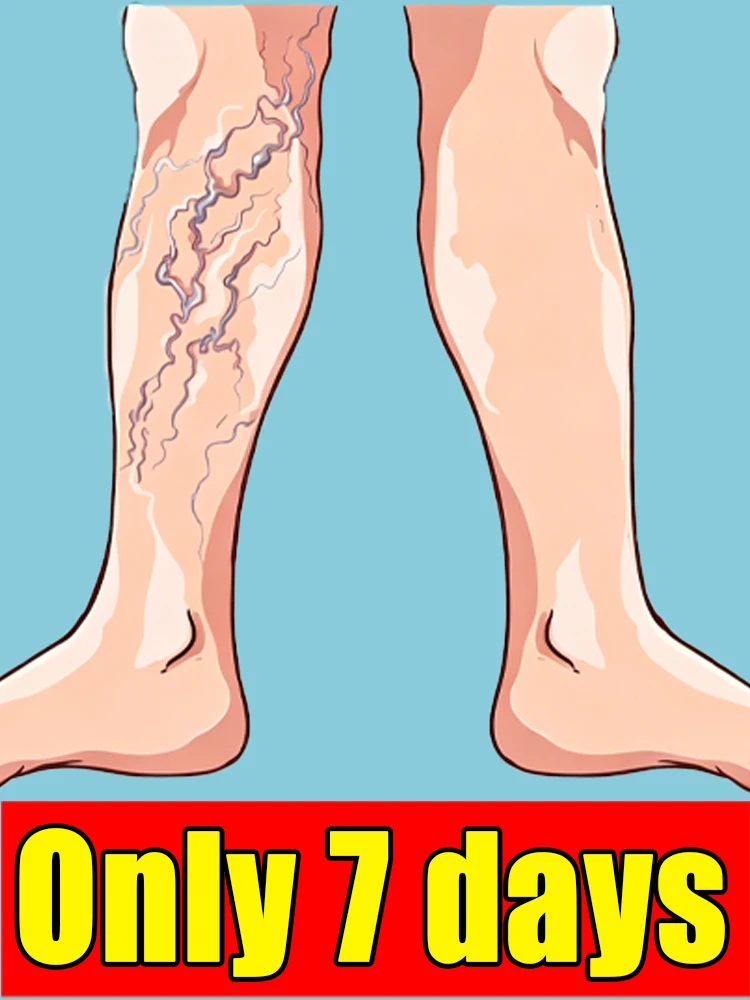 Recovery to health in just 5 days with a blue light pen for leg care.
Recovery to health in just 5 days with a blue light pen for leg care.