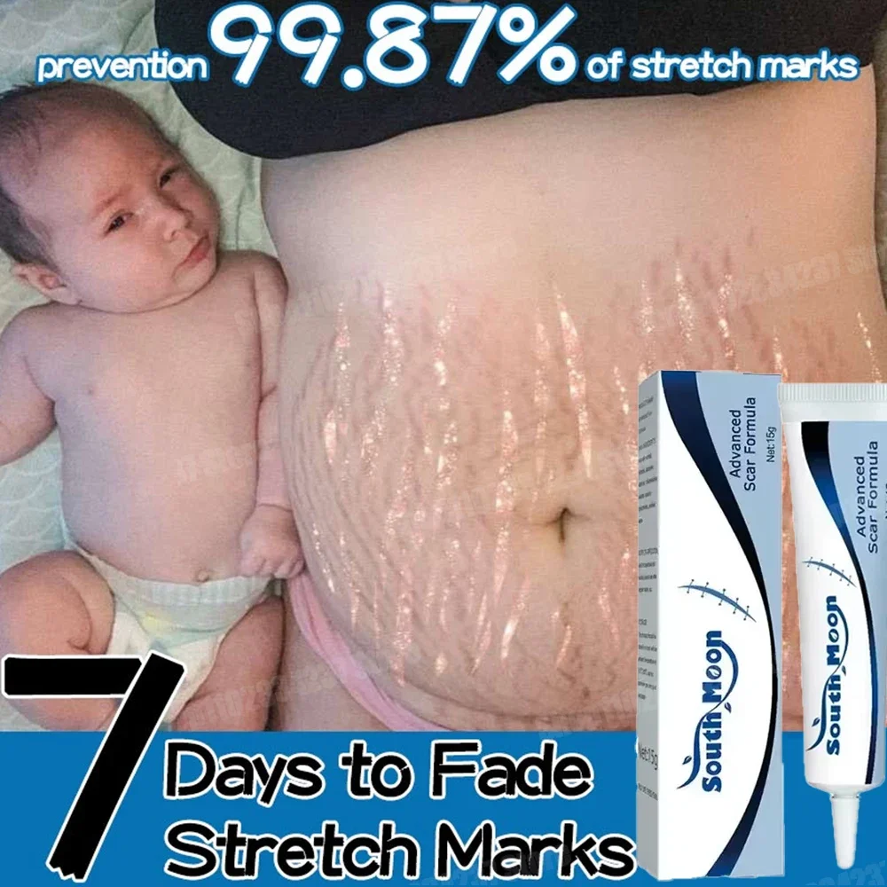 Remove Stretch Marks Skin Care For Pregnant Women Natural Skin Care For Pregnant Women Firmness Smooth Skin
Remove Stretch Marks Skin Care For Pregnant Women Natural Skin Care For Pregnant Women Firmness Smooth Skin