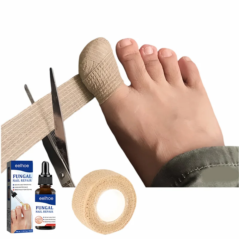 Fungal nail polish, nail coating, toe protection, foot and finger protection, self-adhesive bandage, toe and finger protection
Fungal nail polish, nail coating, toe protection, foot and finger protection, self-adhesive bandage, toe and finger protection