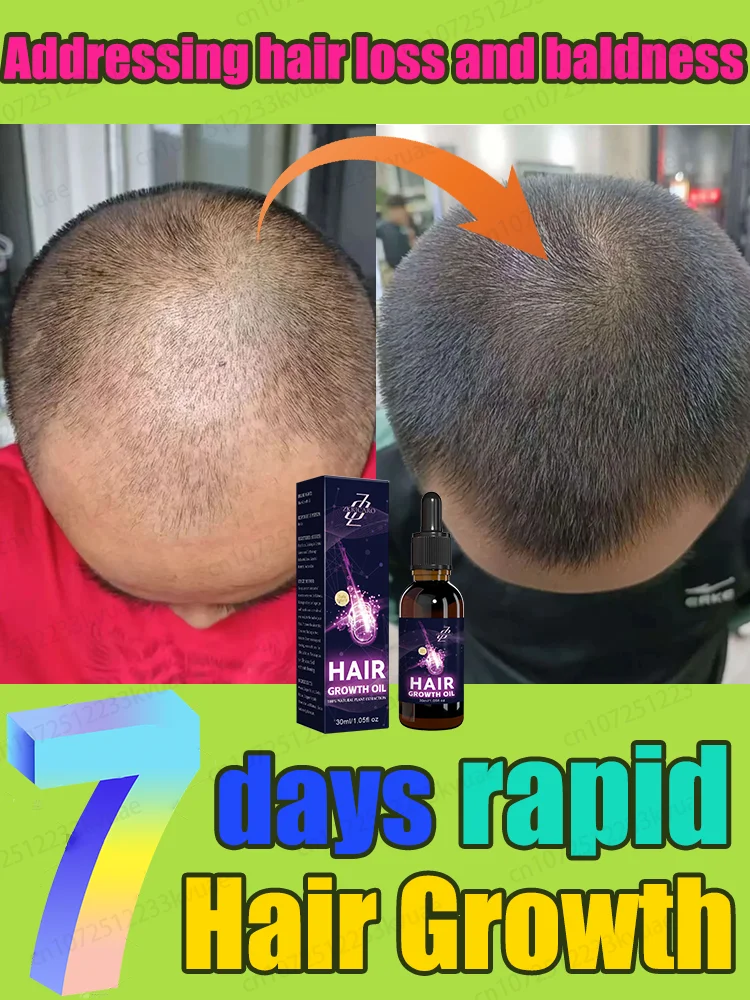 The most effective hair growth essential oil in 2025, grow thick hair in just 7 days
The most effective hair growth essential oil in 2025, grow thick hair in just 7 days