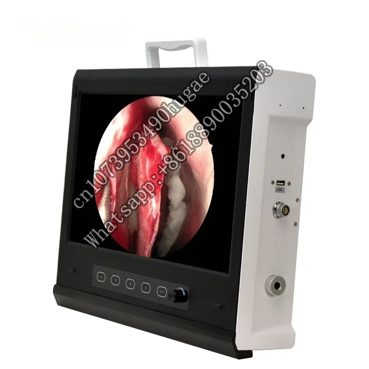 IKEDA НОВАЯ универсальная эндоскопическая система HD для хирургического использования
IKEDA НОВАЯ универсальная эндоскопическая система HD для хирургического использования