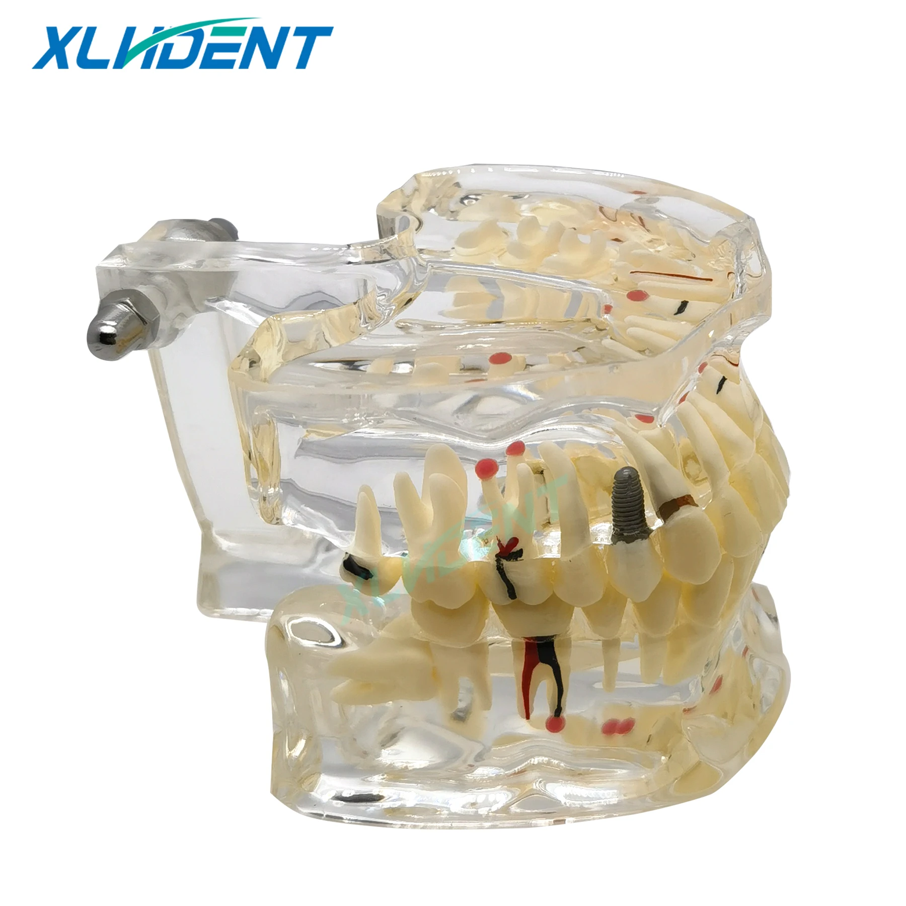 Dental Demonstration Model Perio Adult Pathological Teeth Model Dentist Students Learning, Research Oral Disease Teaching Models
Dental Demonstration Model Perio Adult Pathological Teeth Model Dentist Students Learning, Research Oral Disease Teaching Models