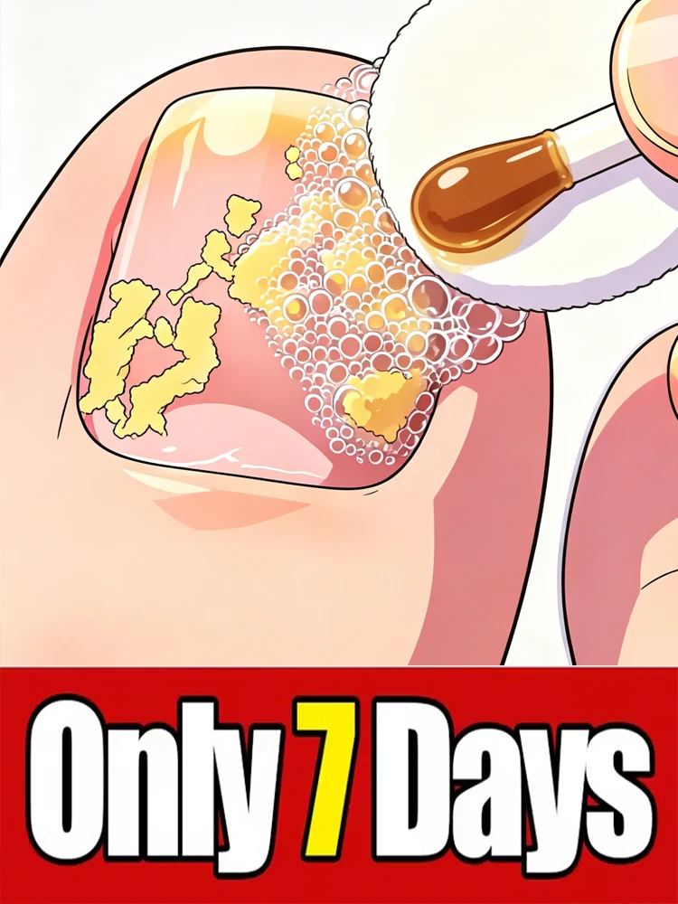 Средство для омоложения ногтей - Технология предотвращения грибка - Регулируемый контроль и датчик безопасности - Больше не нужно беспокоиться о ногтях и говорите «нет» желтизне.
Средство для омоложения ногтей - Технология предотвращения грибка - Регулируемый контроль и датчик безопасности - Больше не нужно беспокоиться о ногтях и говорите «нет» желтизне.