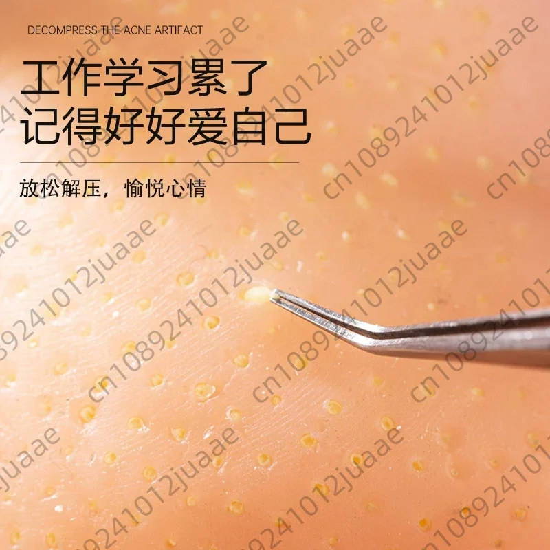 Stress Relief Pimple Squeezing Simulation Doll Blackhead Extractor Tool
Stress Relief Pimple Squeezing Simulation Doll Blackhead Extractor Tool