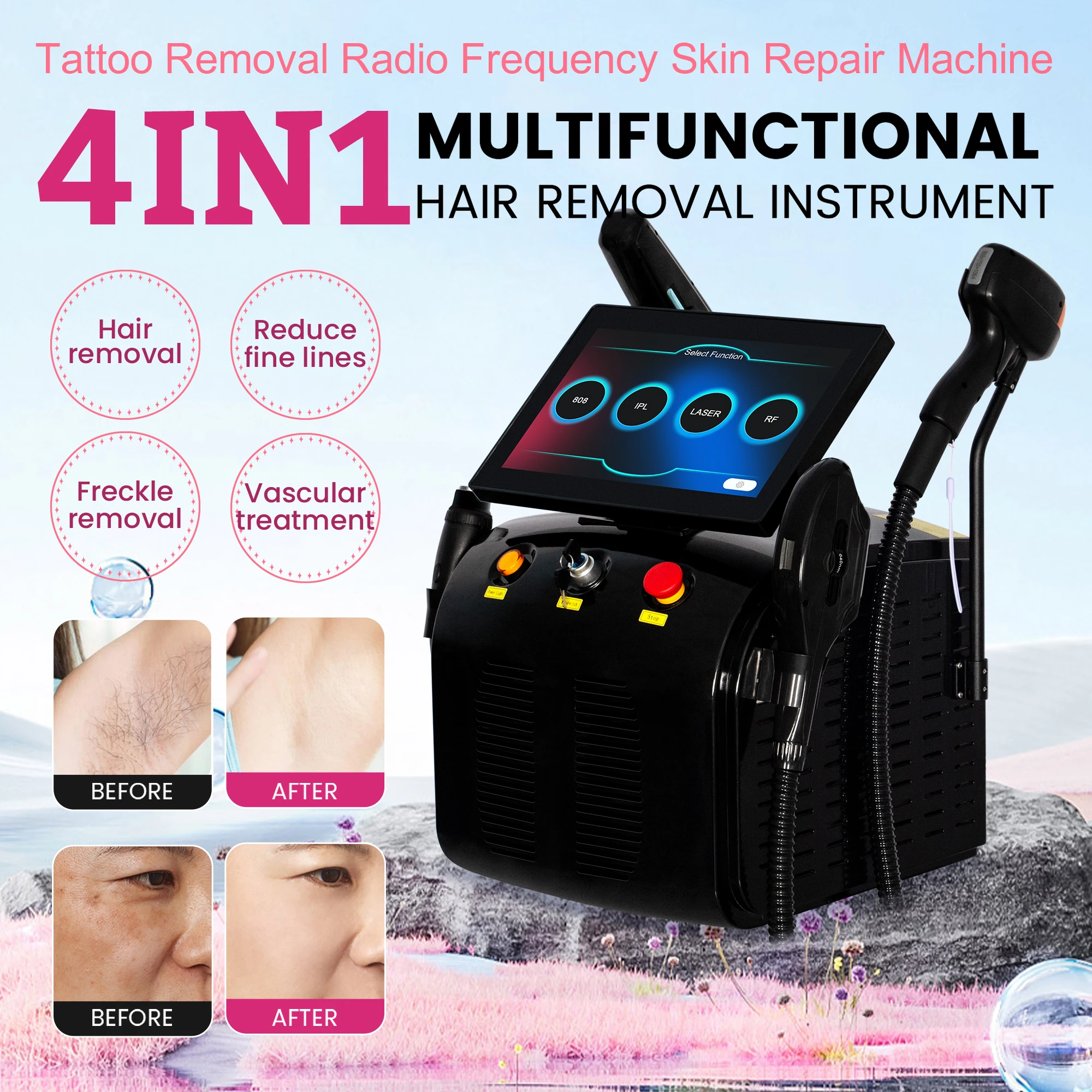 4 in 1 4500W Multifunctional Beauty Machine Diode Laser Pico Laser DPL RF Skin Rejuvenation Hair Removal Tattoo Removal Equipmen
4 in 1 4500W Multifunctional Beauty Machine Diode Laser Pico Laser DPL RF Skin Rejuvenation Hair Removal Tattoo Removal Equipmen