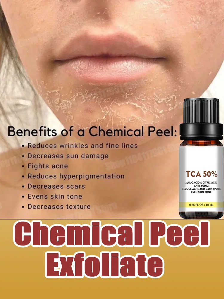 Salicylic Acid Face Facial Peel Neutraliser Face Deep At Home Chemical Peel Exfoliate Refine Skin Care Serum Peeling Serum
Salicylic Acid Face Facial Peel Neutraliser Face Deep At Home Chemical Peel Exfoliate Refine Skin Care Serum Peeling Serum