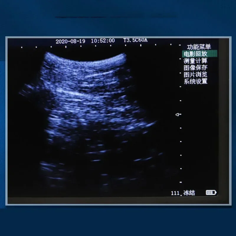 Best sell 1800A Portable veterinary scanner for animal test, suitable for small animals, dogs, cats, pi
Best sell 1800A Portable veterinary scanner for animal test, suitable for small animals, dogs, cats, pi