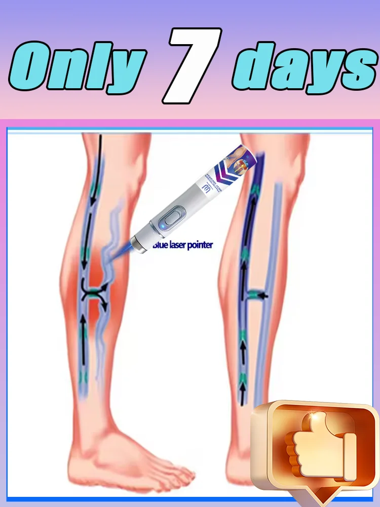 Лазерная ручка для веней Удаление варикозного расширения вен из тела
Лазерная ручка для веней Удаление варикозного расширения вен из тела