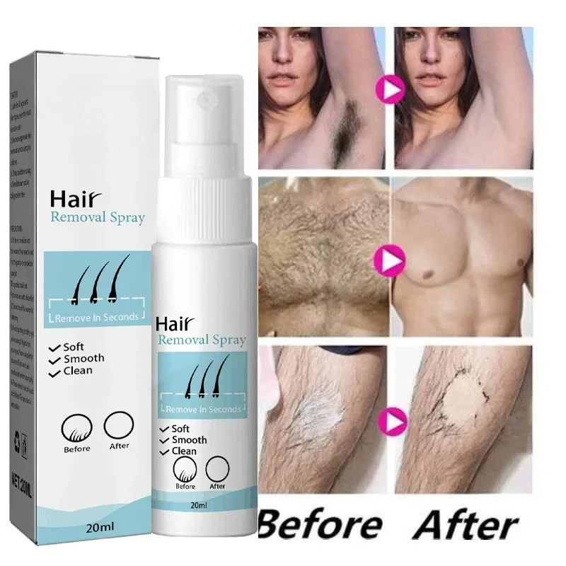Hair Removal Spray Painless Hair Remover Armpit Legs Arms Permanent Hair Growth Inhibitor Depilatory Body Cream Care For Ladies
Hair Removal Spray Painless Hair Remover Armpit Legs Arms Permanent Hair Growth Inhibitor Depilatory Body Cream Care For Ladies