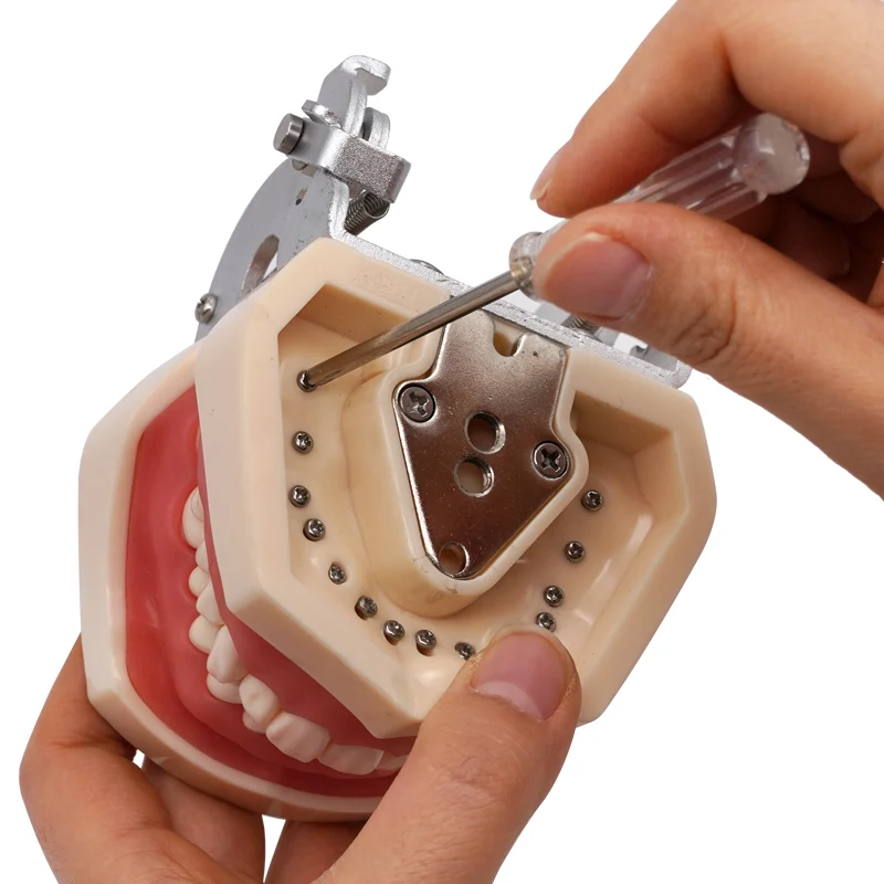 1pc Removable dental model practice, dental teaching model, 28 removable teaching tools for dental particles
1pc Removable dental model practice, dental teaching model, 28 removable teaching tools for dental particles
