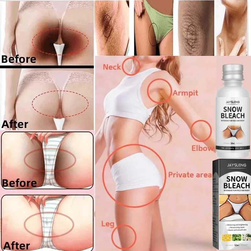 Whitening Cream Private Parts Underarm Bleaching Serum Whiten Butt Knee Brighten Inner Thigh Intimate Parts Dark Remove Melanin
Whitening Cream Private Parts Underarm Bleaching Serum Whiten Butt Knee Brighten Inner Thigh Intimate Parts Dark Remove Melanin
