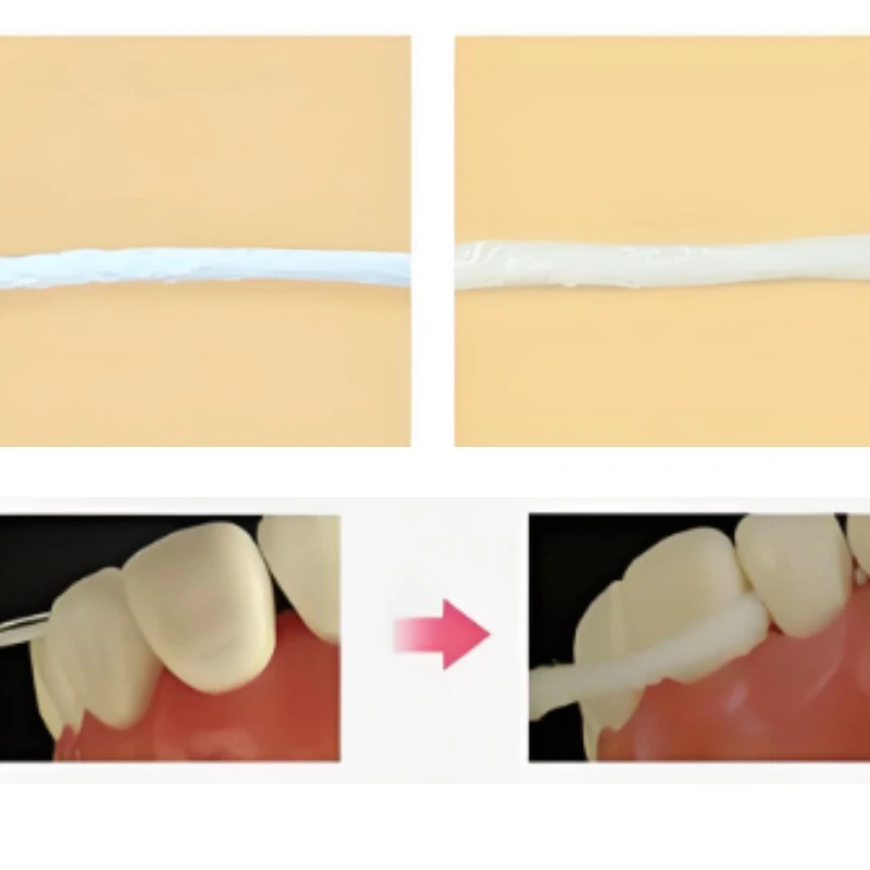 6 Rolls Dental 50m Floss Portable Water Expanded Orthodontic Flosser Mint Flavored Interdental Brush Tooth Cleaning Tools
6 Rolls Dental 50m Floss Portable Water Expanded Orthodontic Flosser Mint Flavored Interdental Brush Tooth Cleaning Tools