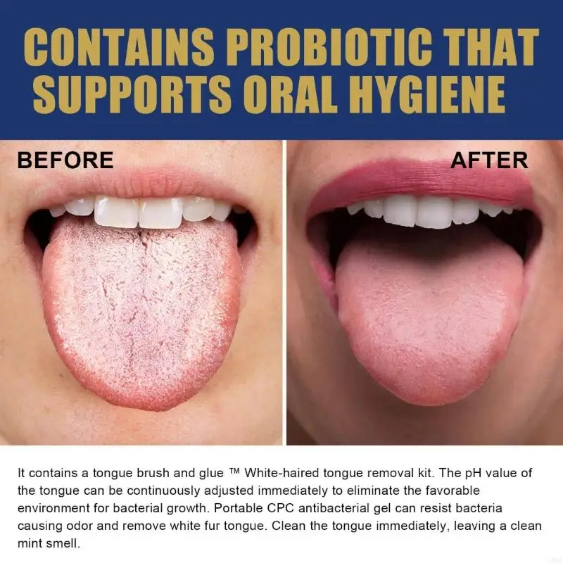 G99E Tongue Scraper and White Hairy Tongue Removal Gel For Mouth Hygiene Maintenance
G99E Tongue Scraper and White Hairy Tongue Removal Gel For Mouth Hygiene Maintenance