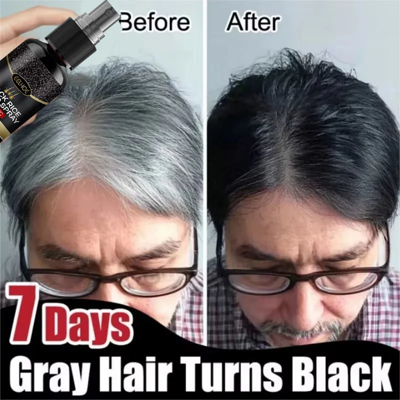 Herbal Gray White Hair Treatment Spray Cover White Hair To Black Natural Color Repair Anti Loss Hair Restore Healthy Hair Care
Herbal Gray White Hair Treatment Spray Cover White Hair To Black Natural Color Repair Anti Loss Hair Restore Healthy Hair Care