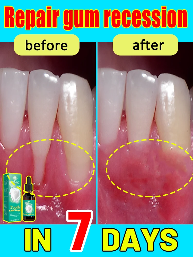 Repair damaged gums, relieve gum pain, strengthen gums, and restore healthy gums
Repair damaged gums, relieve gum pain, strengthen gums, and restore healthy gums