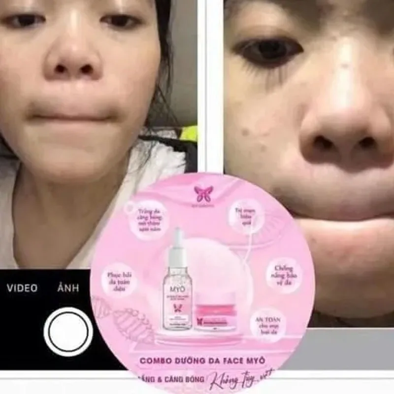КОМПЛЕКТ KÍCH TR уведомления VITAMIN X10 MYÔ, 건tua da mặt collagen, kich trang Combo duong da kem face myo mat body, Trochen da Metà
КОМПЛЕКТ KÍCH TR уведомления VITAMIN X10 MYÔ, 건tua da mặt collagen, kich trang Combo duong da kem face myo mat body, Trochen da Metà