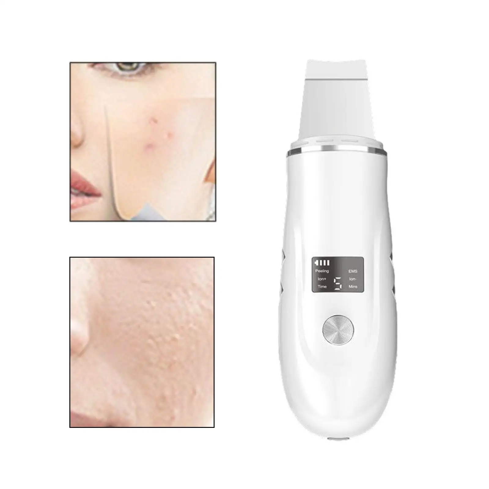 Blackhead Remover Tool Facial Scrubber for Daily Use New Year Holidays
Blackhead Remover Tool Facial Scrubber for Daily Use New Year Holidays