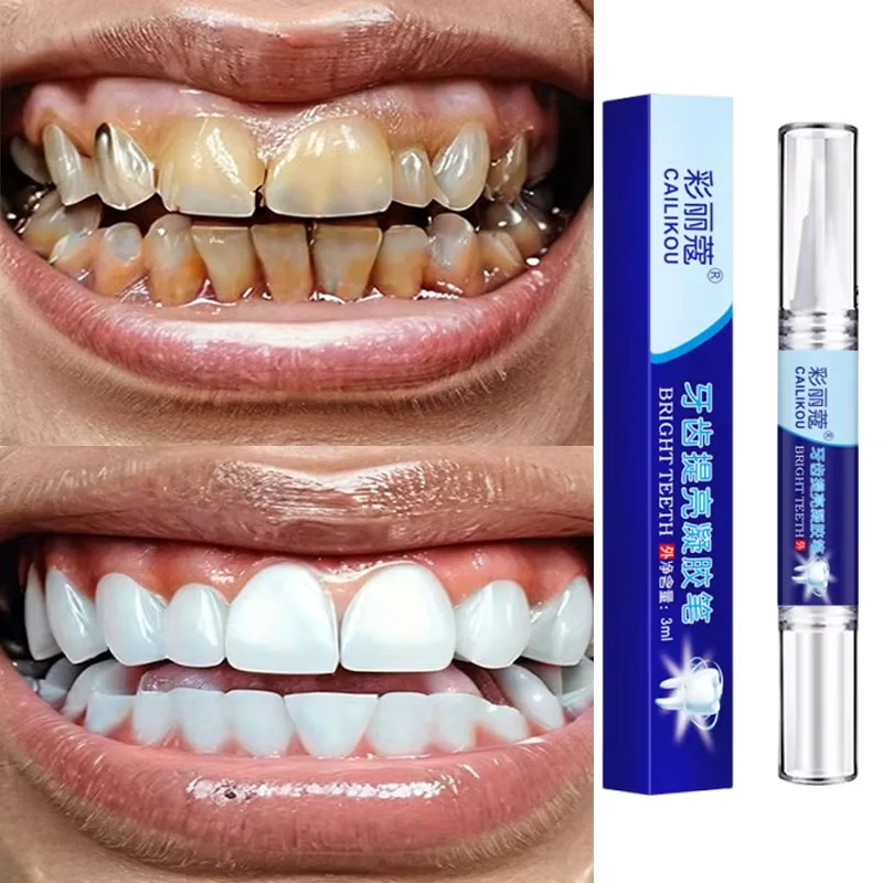 Teeth Whitening Toothpaste Serum Pen Remove Plaque Stains Oral Hygiene Cleaning Dental Bleaching Tools Fresh Breath Tooth Care
Teeth Whitening Toothpaste Serum Pen Remove Plaque Stains Oral Hygiene Cleaning Dental Bleaching Tools Fresh Breath Tooth Care