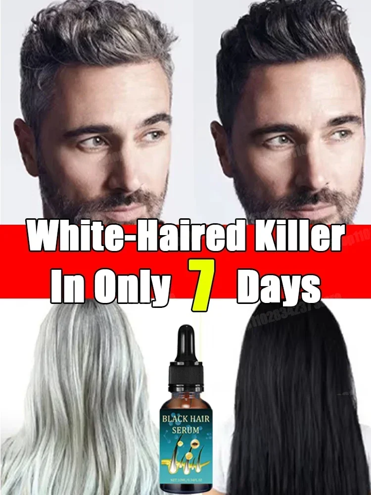 Revitalize Your Hair Color and Health with Anti-Grey Hair Natural Anti-Grey Serum Remedy Healthy Essence Serum
Revitalize Your Hair Color and Health with Anti-Grey Hair Natural Anti-Grey Serum Remedy Healthy Essence Serum