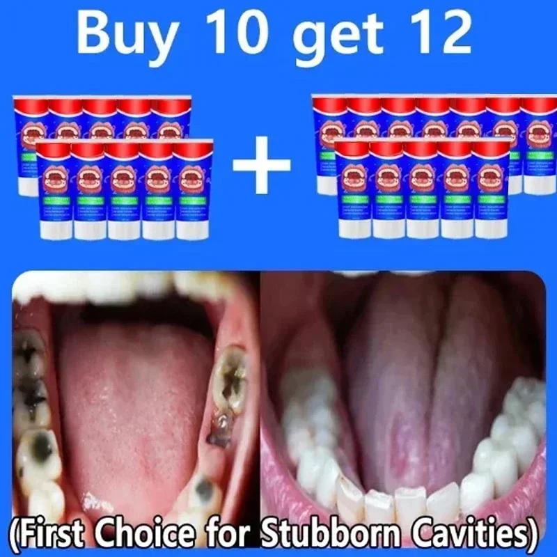 Whitening Fresh Breath Brightening Purple Toothpaste Remove Stain Reduce Yellowing Care for Teeth Gums Oral Tooth Decay Repair
Whitening Fresh Breath Brightening Purple Toothpaste Remove Stain Reduce Yellowing Care for Teeth Gums Oral Tooth Decay Repair