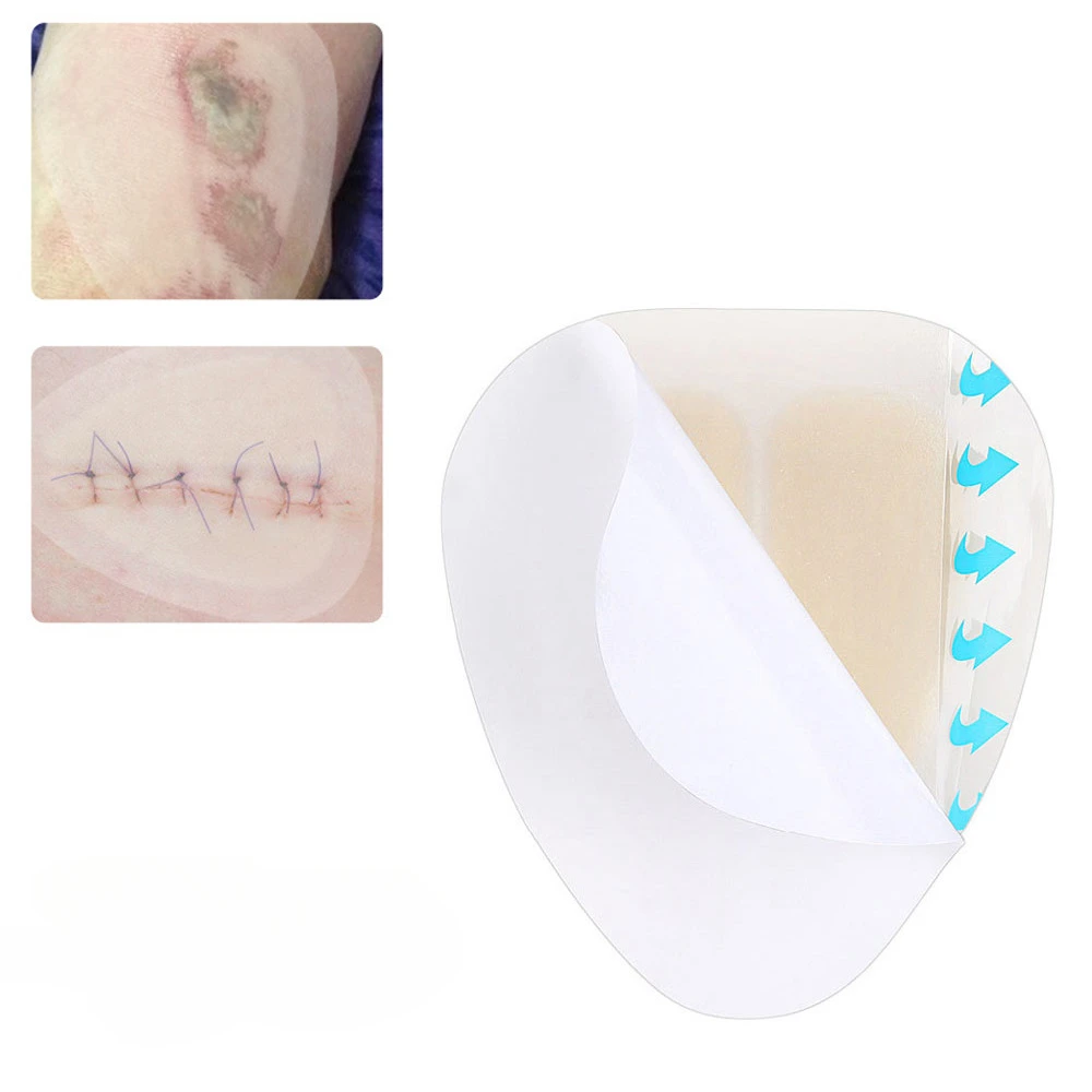 Медицинская повязка на рану, стерильная кровоостанавливающая тонкая лечебная подушечка, гидроколлоидная клейкая нашивка, тонкая самоклеящаяся дышащая подушечка
Медицинская повязка на рану, стерильная кровоостанавливающая тонкая лечебная подушечка, гидроколлоидная клейкая нашивка, тонкая самоклеящаяся дышащая подушечка