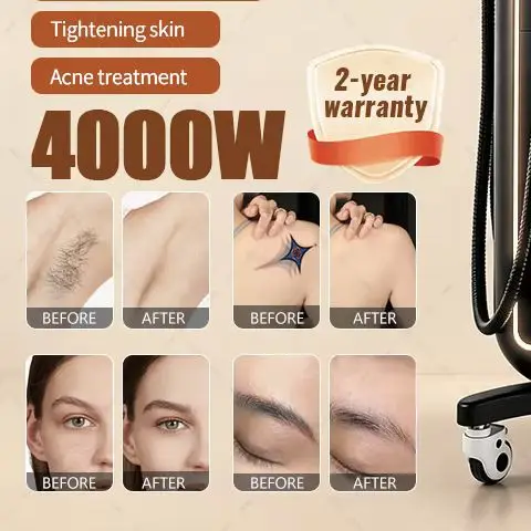 5000W 4 Waves Soprano Titanium Ice Care Device Multifunctional Painless Body Hair Removal Skin Rejuvenation 4 In 1 Beauty Device
5000W 4 Waves Soprano Titanium Ice Care Device Multifunctional Painless Body Hair Removal Skin Rejuvenation 4 In 1 Beauty Device