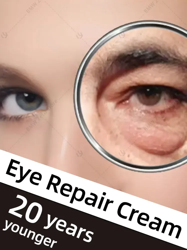 Fast Eye Bag Remover Retinol Anti-wrinkle Firming Skin Lightening Fine Lines Anti-dark circles Puffiness Bright Eye Care
Fast Eye Bag Remover Retinol Anti-wrinkle Firming Skin Lightening Fine Lines Anti-dark circles Puffiness Bright Eye Care
