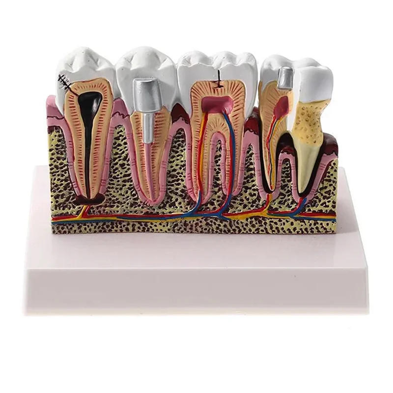 ABLN-Standard Oral Teeth Anatomical Teaching Model Comprehensive Tooth Structure Model Dentist Demonstration
ABLN-Standard Oral Teeth Anatomical Teaching Model Comprehensive Tooth Structure Model Dentist Demonstration