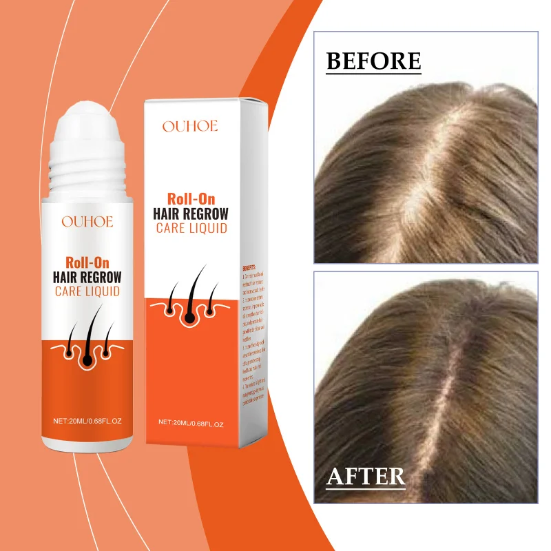 Roll-On Hair Oil - Intensive Repair, Shine Boost, Scalp Nourishment - Herbal Hair Roller Balls For Thicker & Healthier Hair
Roll-On Hair Oil - Intensive Repair, Shine Boost, Scalp Nourishment - Herbal Hair Roller Balls For Thicker & Healthier Hair