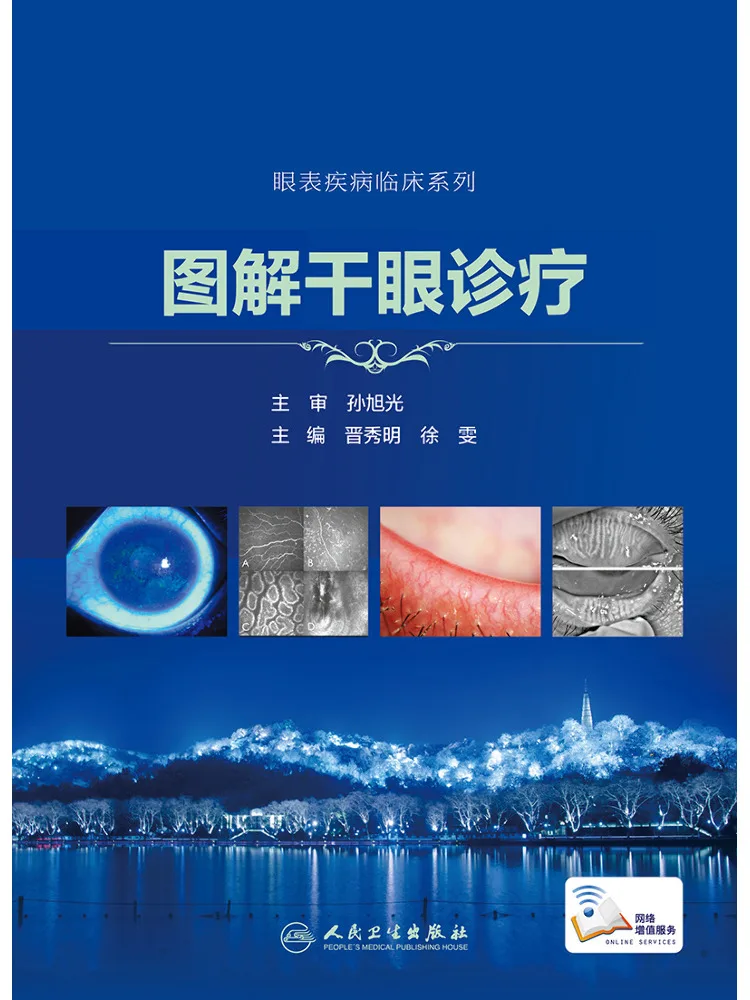 Book-Winshare Illustrated Dry Eye Diagnosis and Treatment
Book-Winshare Illustrated Dry Eye Diagnosis and Treatment