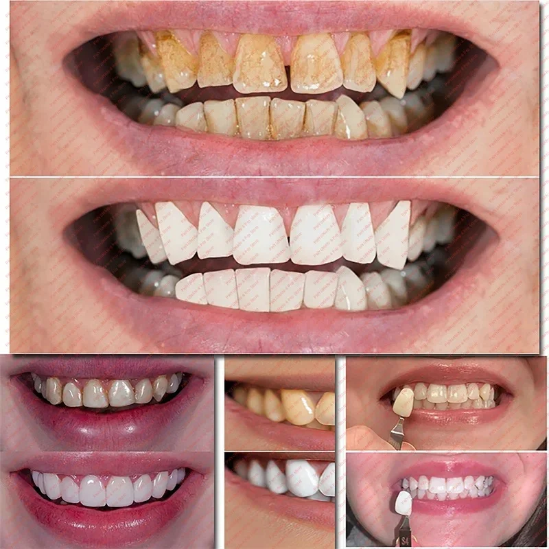 Tooth Whitening Pen Dazzling White Teeth Whitening Pen Instant Teeth Whitening Pen Brighten Your Smile Tooth Hygiene Care Tools
Tooth Whitening Pen Dazzling White Teeth Whitening Pen Instant Teeth Whitening Pen Brighten Your Smile Tooth Hygiene Care Tools