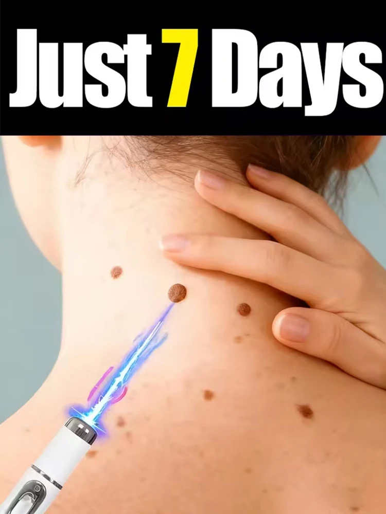 ᴱˣᶠᵒˡⁱᵃᵗⁱⁿᵍ ᵃⁿᵈ ᵐᵒˡᵉ ʳᵉᵐᵒᵛᵃˡ blue light pen, suitable for daily use, latest best-selling blue light pen
ᴱˣᶠᵒˡⁱᵃᵗⁱⁿᵍ ᵃⁿᵈ ᵐᵒˡᵉ ʳᵉᵐᵒᵛᵃˡ blue light pen, suitable for daily use, latest best-selling blue light pen