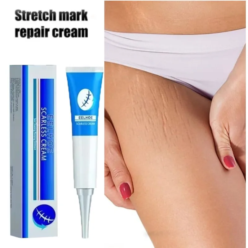 Remove Stretch Mark Cream Anti-wrinkle Anti-aging Maternal Repair Remove Pregnancy Hydrates and moisturize deeply Body Skin Care
Remove Stretch Mark Cream Anti-wrinkle Anti-aging Maternal Repair Remove Pregnancy Hydrates and moisturize deeply Body Skin Care