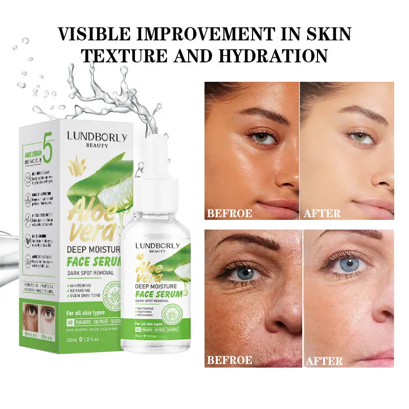 Aloe Radiance Serum Improves Dullness Brightens Skin Tone Hydrates and Moisturizes Lightweight and Non Greasy Facial Essence
Aloe Radiance Serum Improves Dullness Brightens Skin Tone Hydrates and Moisturizes Lightweight and Non Greasy Facial Essence