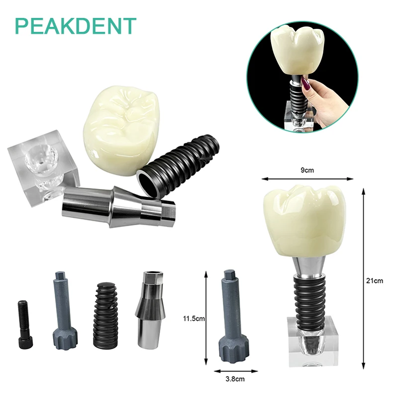 Dental Large Single Tooth Removable Crystal Implant Model Demonstration Tool Dental Student Teaching Research Model
Dental Large Single Tooth Removable Crystal Implant Model Demonstration Tool Dental Student Teaching Research Model