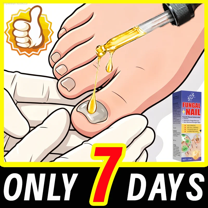 Gentle ғᴜɴɢᴀʟ ɴᴀɪʟ repair, restoring healthy and shiny ɴᴀɪʟs
Gentle ғᴜɴɢᴀʟ ɴᴀɪʟ repair, restoring healthy and shiny ɴᴀɪʟs