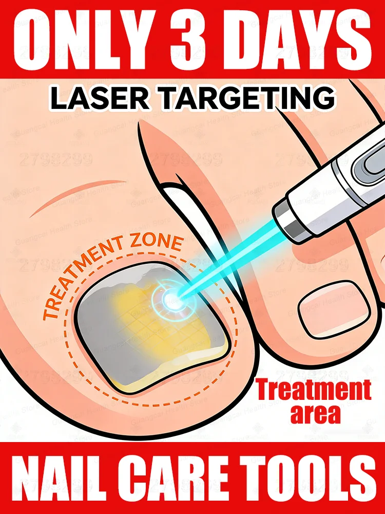 Thickened nails soften and regain their smoothness,ᵍᵉⁿᵗˡʸ ᵉˡⁱᵐⁱⁿᵃᵗⁱⁿᵍ ᶠᵘⁿᵍᵘˢ ʷʰⁱˡᵉ ᵖʳᵒᵗᵉᶜᵗⁱⁿᵍ ᵗʰᵉ ⁿᵃⁱˡˢ‧
Thickened nails soften and regain their smoothness,ᵍᵉⁿᵗˡʸ ᵉˡⁱᵐⁱⁿᵃᵗⁱⁿᵍ ᶠᵘⁿᵍᵘˢ ʷʰⁱˡᵉ ᵖʳᵒᵗᵉᶜᵗⁱⁿᵍ ᵗʰᵉ ⁿᵃⁱˡˢ‧