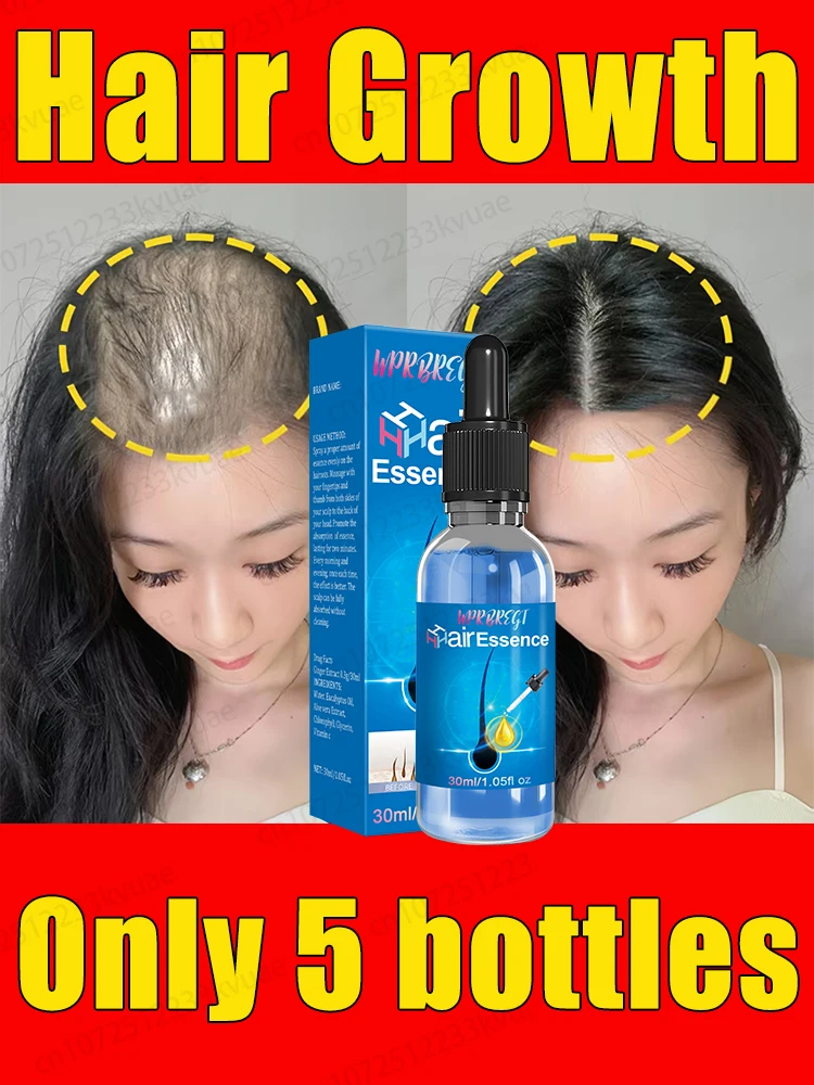 Double hair growth essential oil, the result of plant essence research, say goodbye to baldness and hair loss, without harming t
Double hair growth essential oil, the result of plant essence research, say goodbye to baldness and hair loss, without harming t