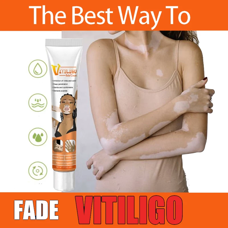 Vitiligo Ointment Ringworm Effectively Remove White Spot Removal Skin Vitiligo Eliminate Vitiligo Body Skin Care
Vitiligo Ointment Ringworm Effectively Remove White Spot Removal Skin Vitiligo Eliminate Vitiligo Body Skin Care