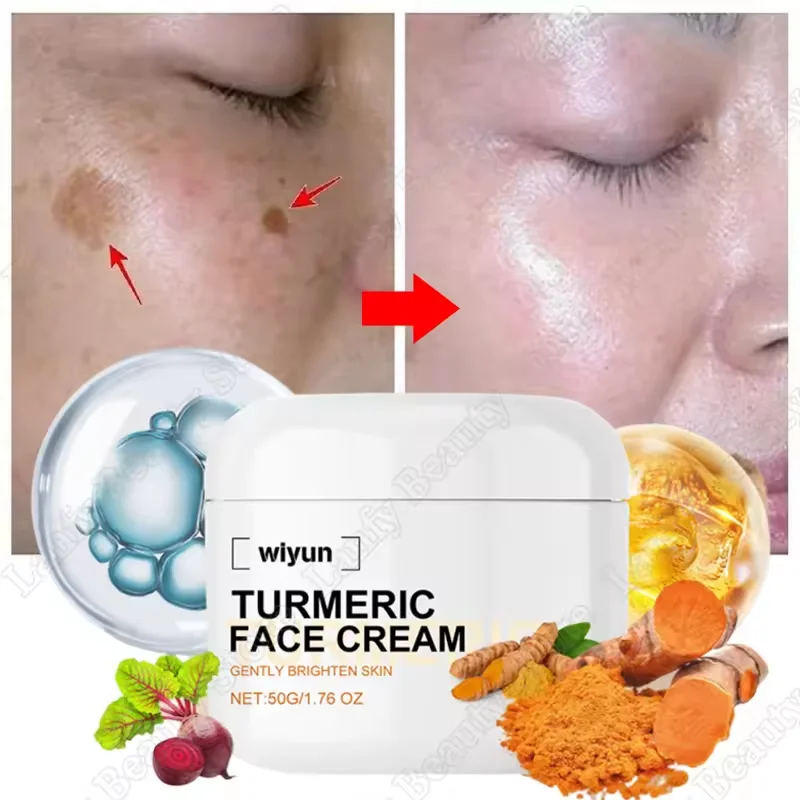 Retinol Natural Turmeric Vitamin C Whitening Face Cream Moisturizing Firming Hyaluronic Lightening Fade Fine Lines Skin Care
Retinol Natural Turmeric Vitamin C Whitening Face Cream Moisturizing Firming Hyaluronic Lightening Fade Fine Lines Skin Care
